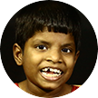 How physiotherapy is helping Kalpaga get back to normal